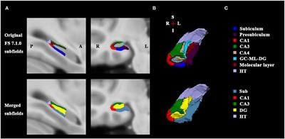 Disruption in Surface-Based Functional Connectivity in the Right Posterior Hippocampal CA3 Subfield: A Probable Neural Basis of Visuospatial Working Memory Impairment in Patients With Right Temporal Lobe Epilepsy